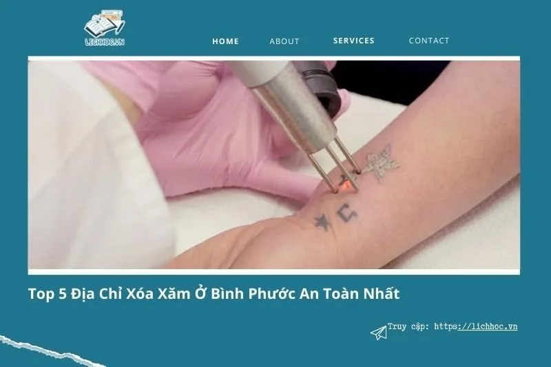 Top 5 địa chỉ xóa xăm ở Bình Phước uy tín và an toàn nhất